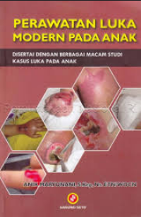 Image of Perawatan luka modern pada anak : disertai dengan berbagai macam studi kasus luka pada anak