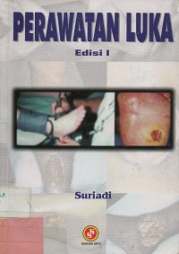 Image of Perawatan luka edisi 1